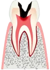 Сложные зубы лечение краснодар thumbnail